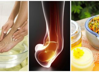 9 remedii de casa pentru a ameliora entorsa gleznei