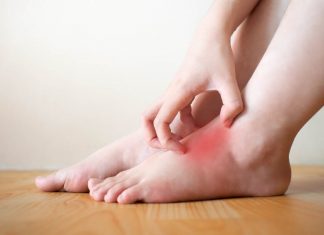 Cunoasterea hidropiziei: simptome si tratament