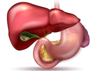 Plante medicinale pentru tratarea calculilor biliari