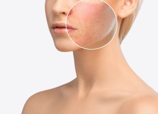 12 probleme comune ale pielii si cele mai bune modalitati de a le rezolva